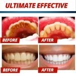 Intensive-Stain-Removal-Whitening-Toothpaste