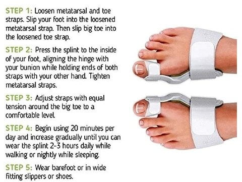 Orthopedic Bunion Corrector 14 Orthopedic Bunion Corrector