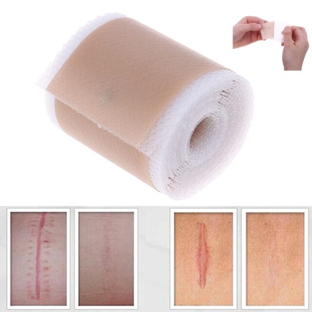 Efficient Surgery Scar Removal Silicone Gel - JDGOSHOP - Creative Gifts