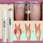 Blue-Light-Therapy-Pen-for-Varicose-Veins