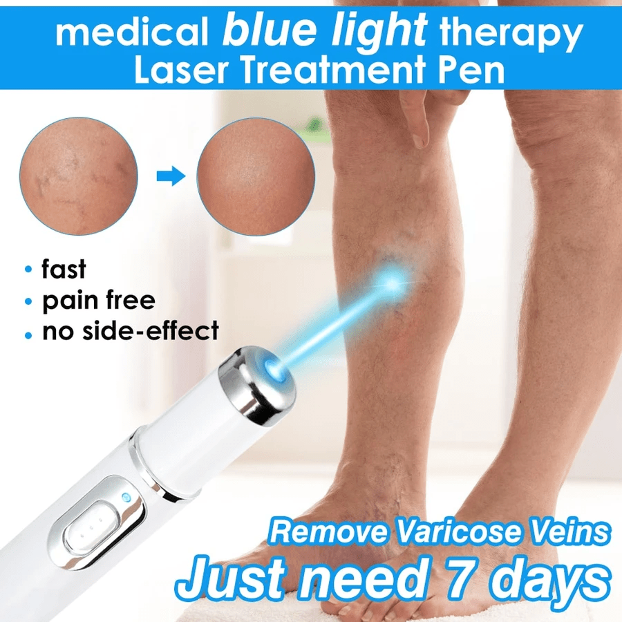 Blue Light Therapy Pen for Varicose Veins Creative Gifts, Funny Products, Practical