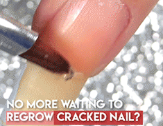 Cracked Nail Repair Gel 3